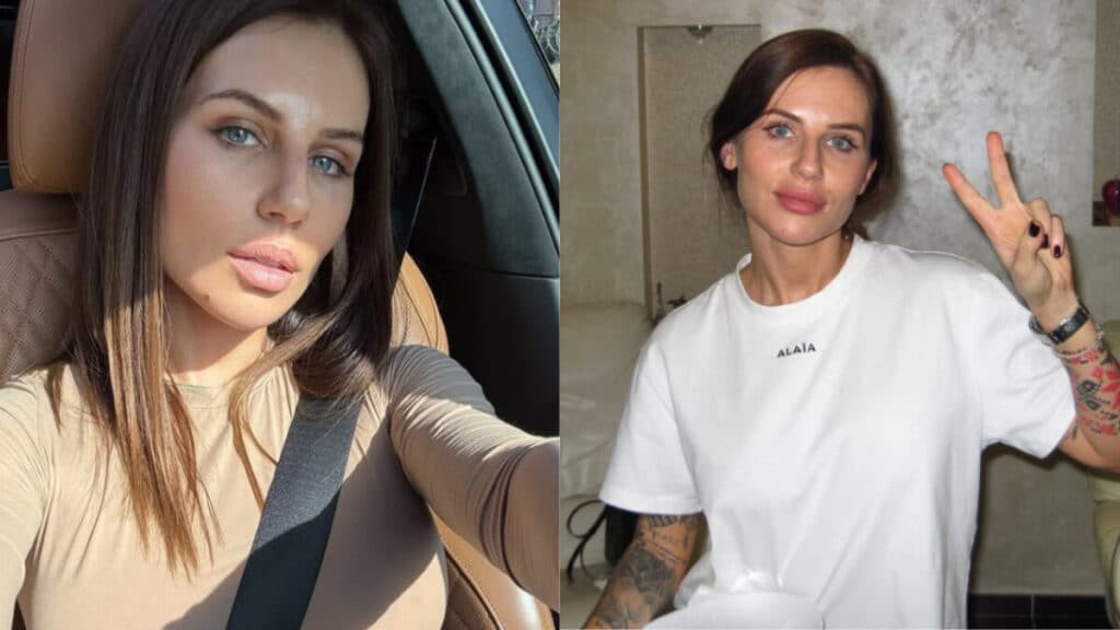Ukrainian Instagram Star Anna Alkhimova Wins Legal Battle Against